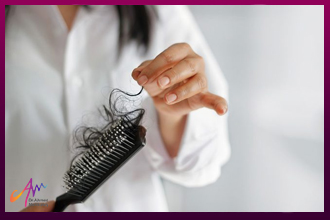 علاج تساقط الشعر للنساء بالماسكات الطبيعية وحقن البلازما