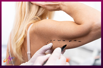 Slimming and Sculpting the Arms